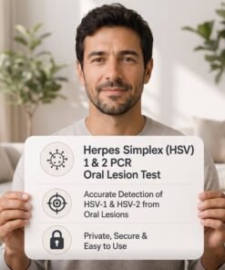 Herpes Simplex (HSV) 1 & 2 by PCR – Oral Lesion Test