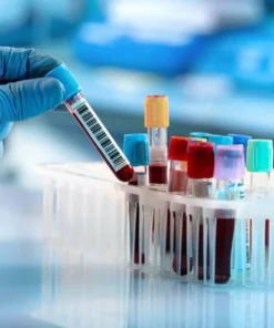 Amylase Blood Test UK | Pancreatic & Digestive Health Test